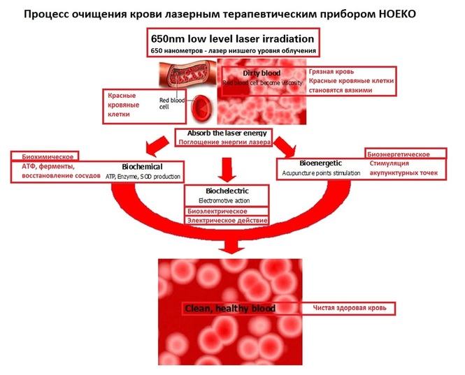 Процесс очищения крови лазерным терапевтическим прибором HOEKO